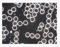 photo du sang au microscope fond noir avec protection ondes électromagnétiques
